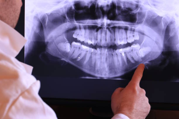 Best Emergency Treatment for Dental Infections or Abscesses in French Lick, IN