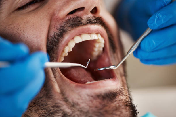 Best Cosmetic Emergency Dentistry in French Lick, IN